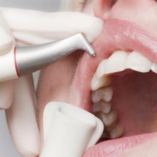 Hygiéniste dentaire diplômée depuis 3 ans cherche collaboration 