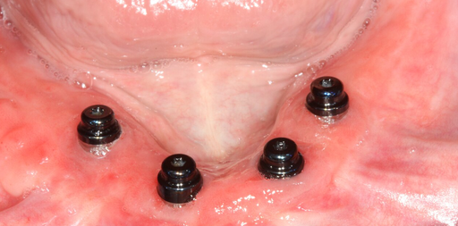 Chirurgien-dentiste · Implantologiste · Prothèse complète & Hollywood Smile — 30 ans d'expérience —