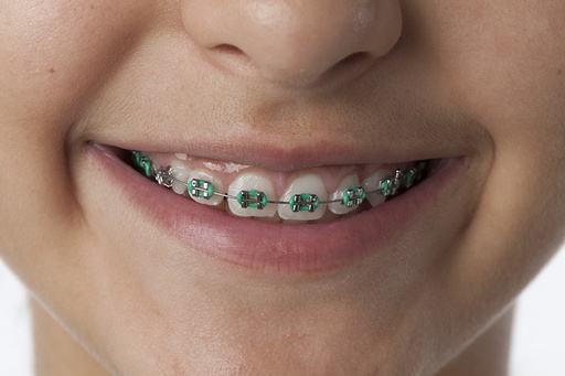 Orthodontiste