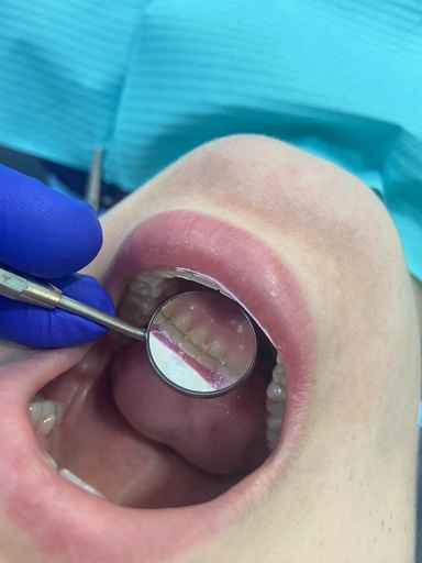 Hygieniste cherche 1-2 jrs sem