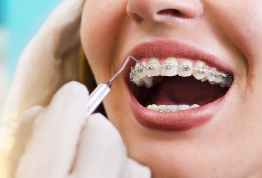 Groupe d’orthodontie recherche cabinet à reprendre – Bruxelles / Wallonie