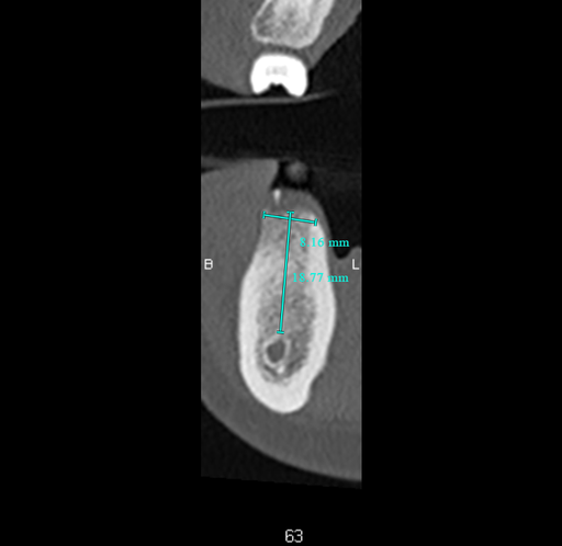 Recherche dentiste generaliste Bruxelles