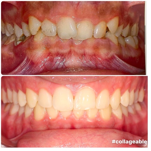 cabinet dentaire a Berchem-saite-Agathe cherche assistante 