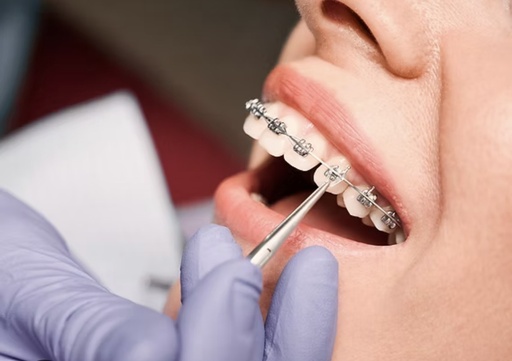 Orthodontiste recherché(e) – 2 à 3 jours/semaine