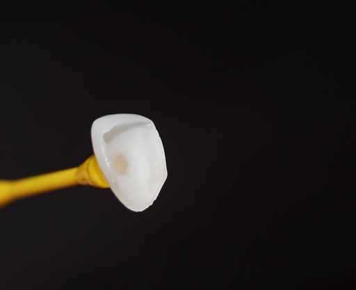 Dentiste cherche collaboration pour la prothèse fixe et amovible