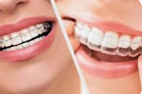 Ortho exclusif cherche complement activité 